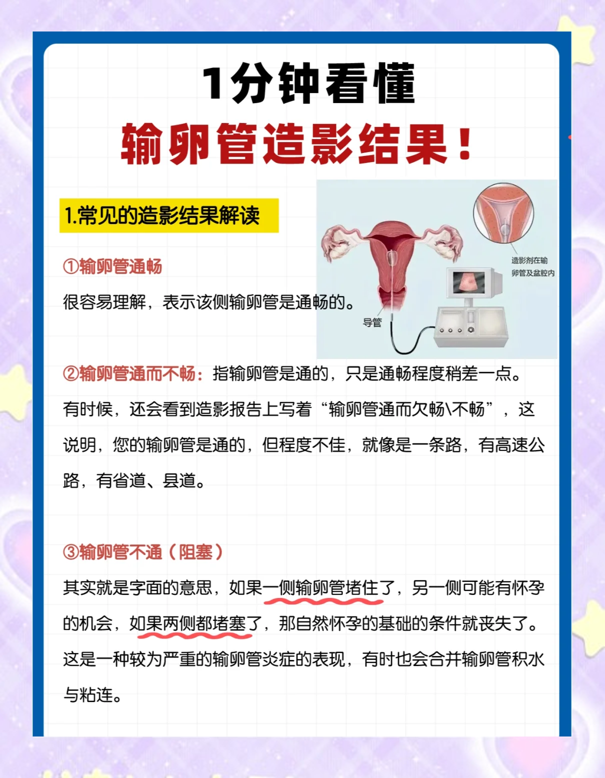 输卵管造影是检查什么的?