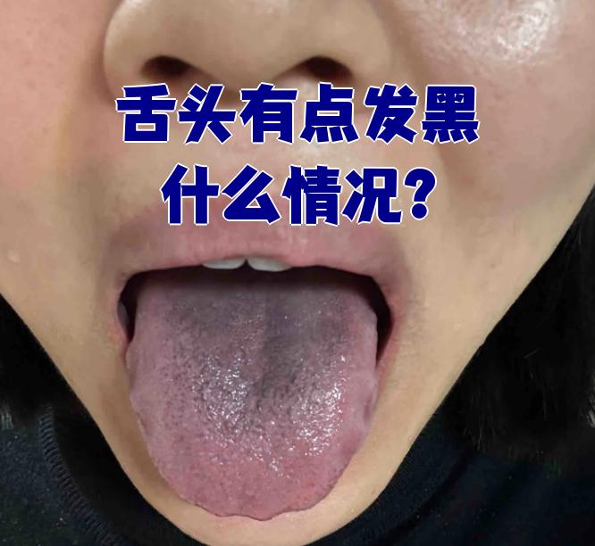 舌头发涩怎么回事?
