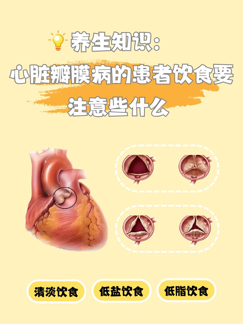 心脏瓣膜病能活多久