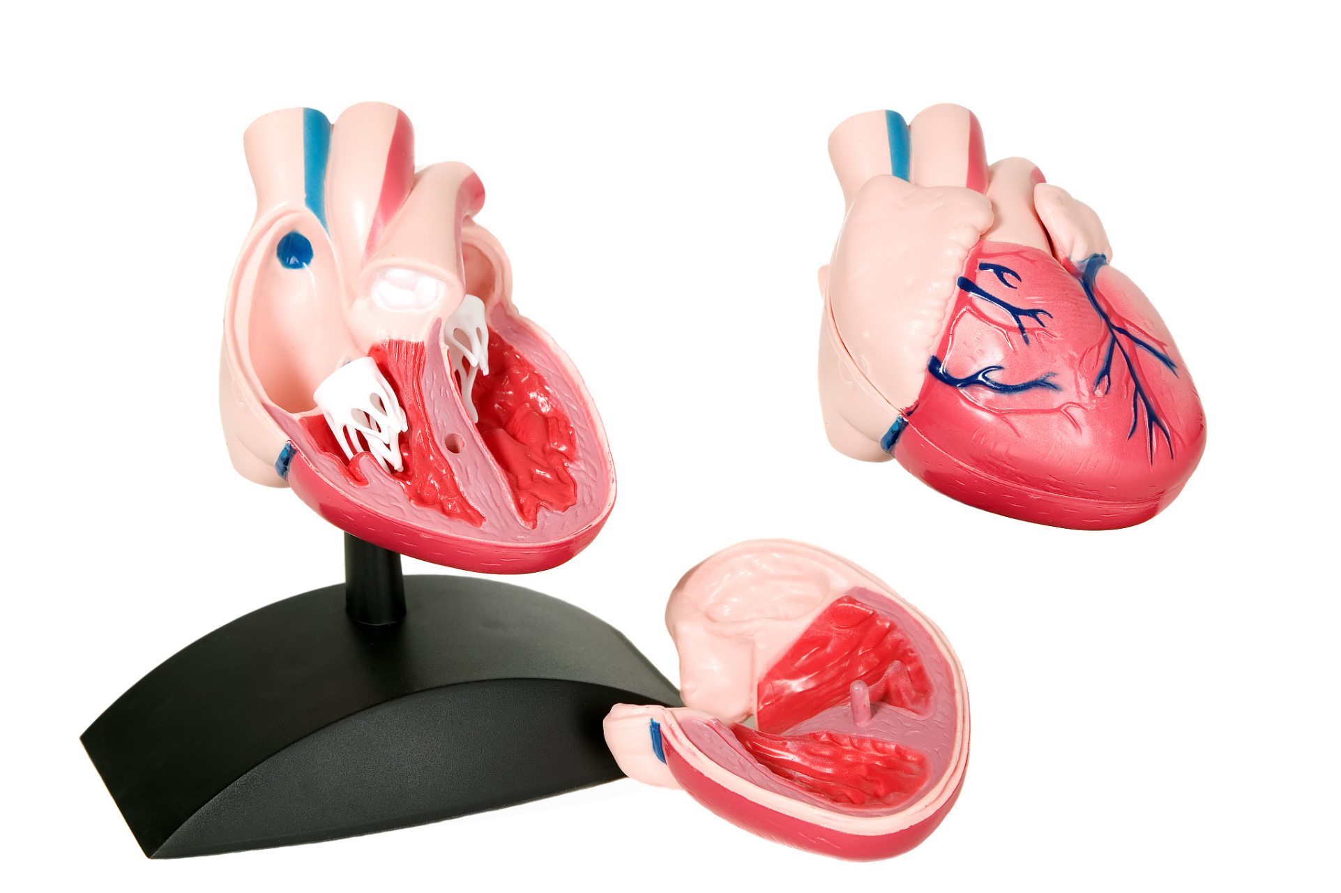 心脏瓣膜病能活多久