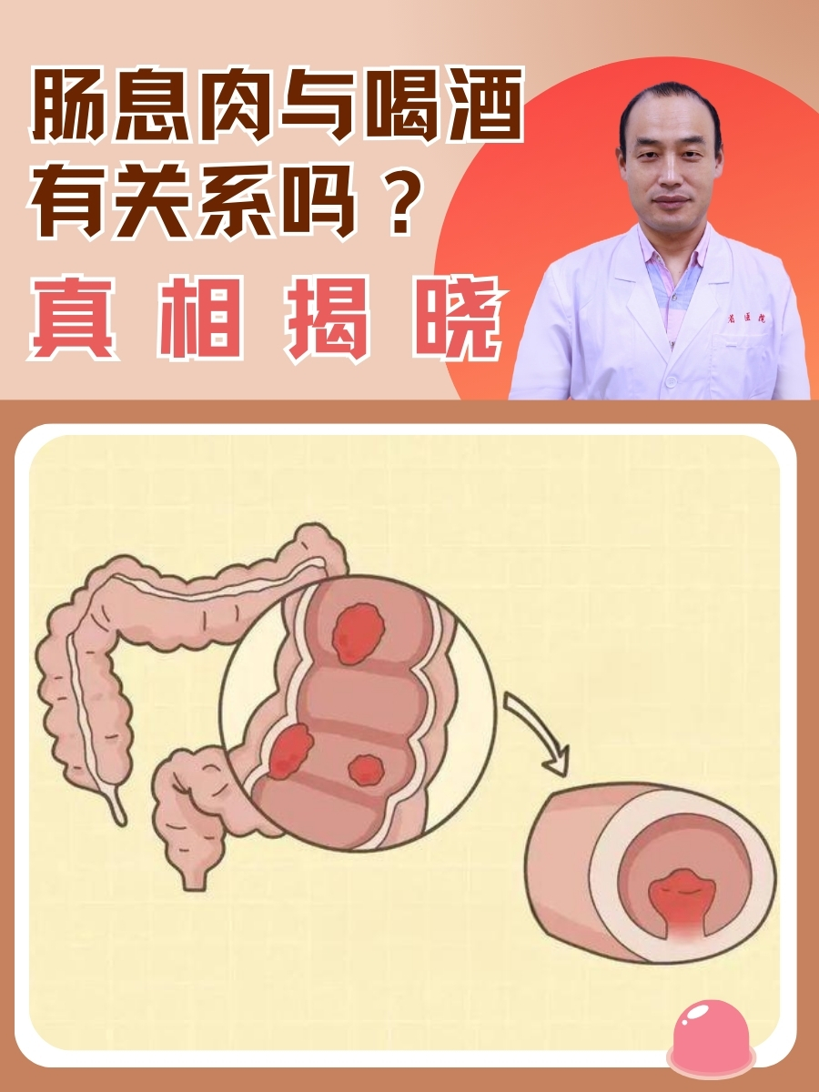 大肠息肉是什么