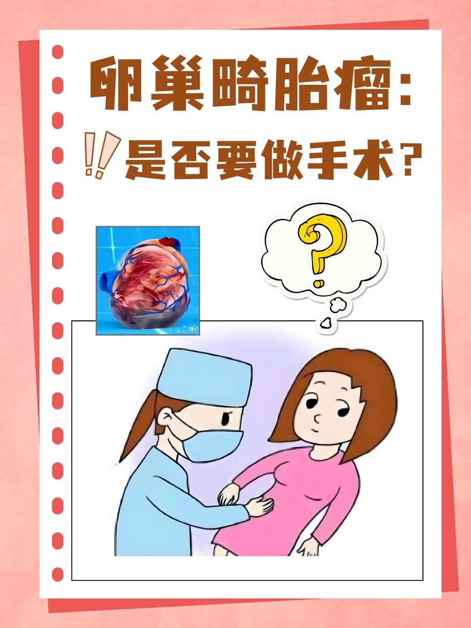 卵巢畸胎瘤严重吗