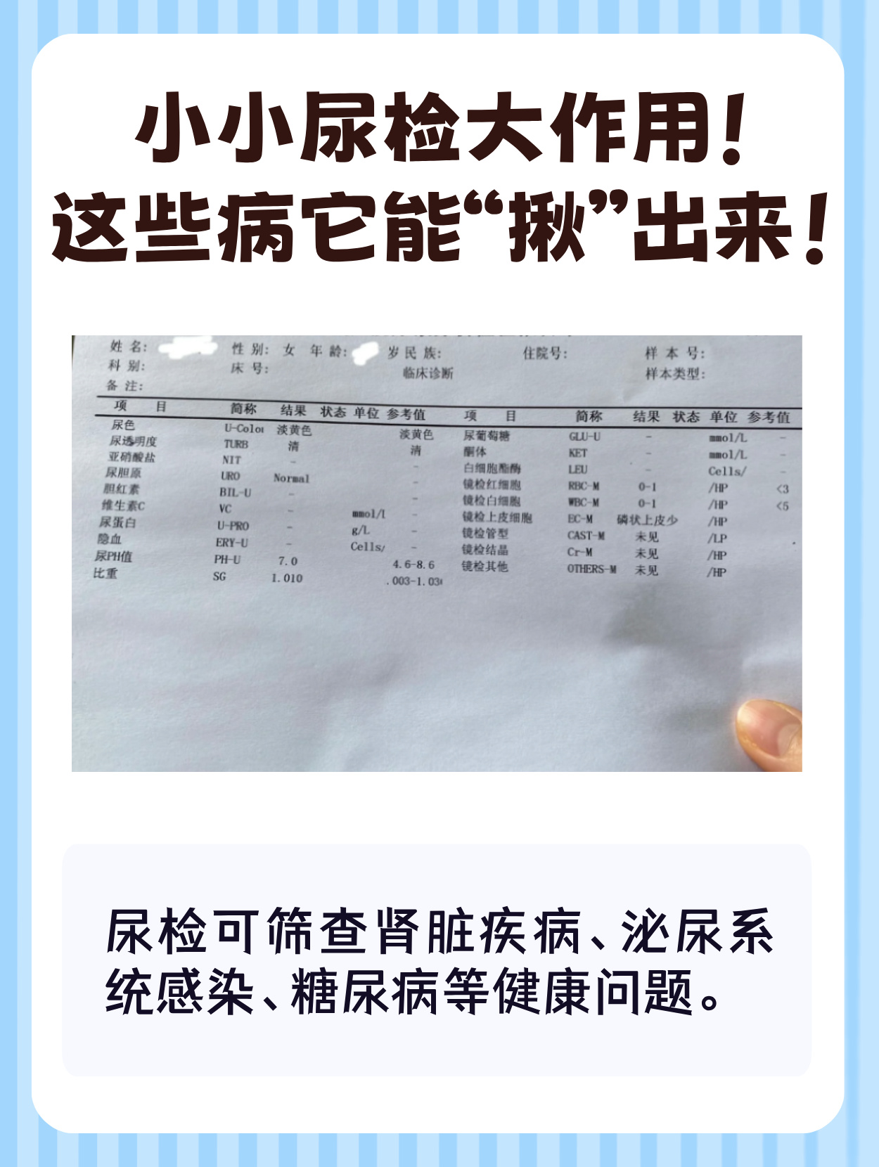 尿常规检查可以检查出淋病吗?