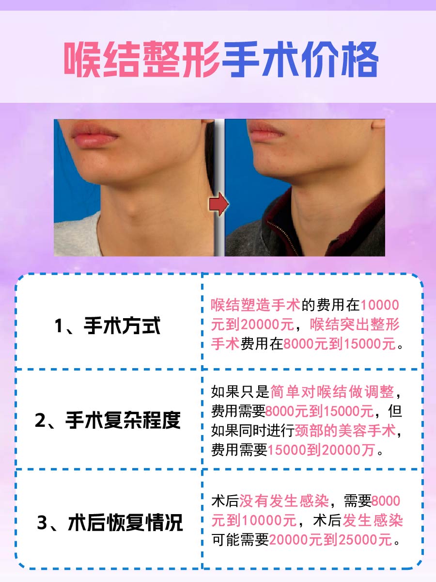 做个整形手术要花多少钱?