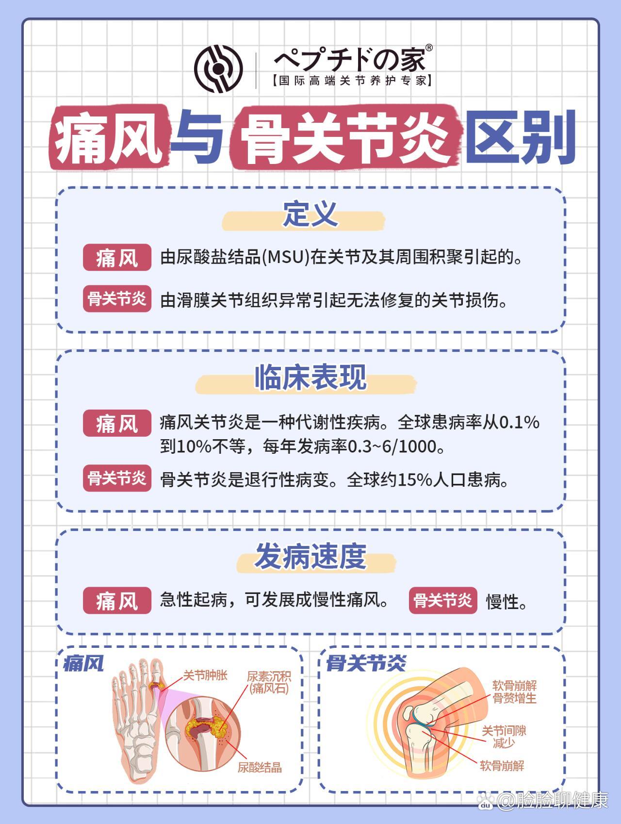 骨关节炎能治好吗