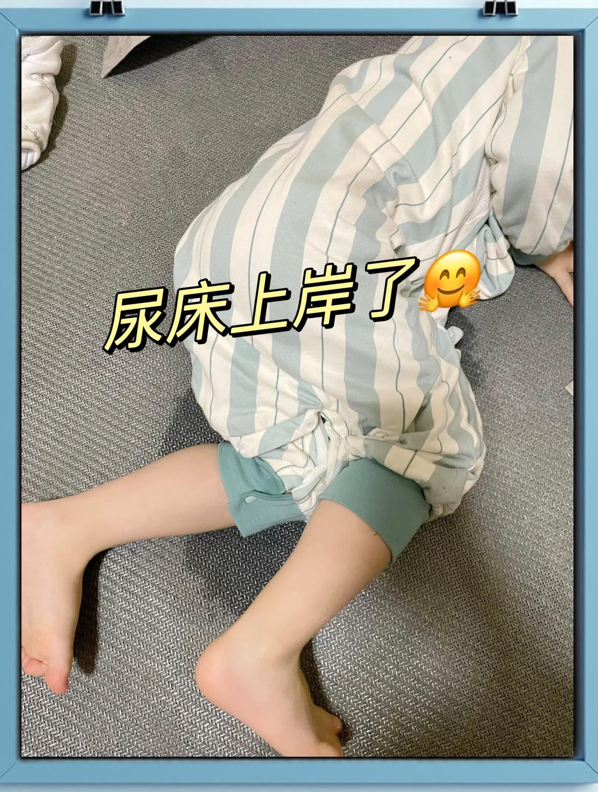 儿童遗尿症