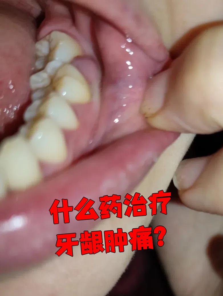 牙龈增长切除痛吗?