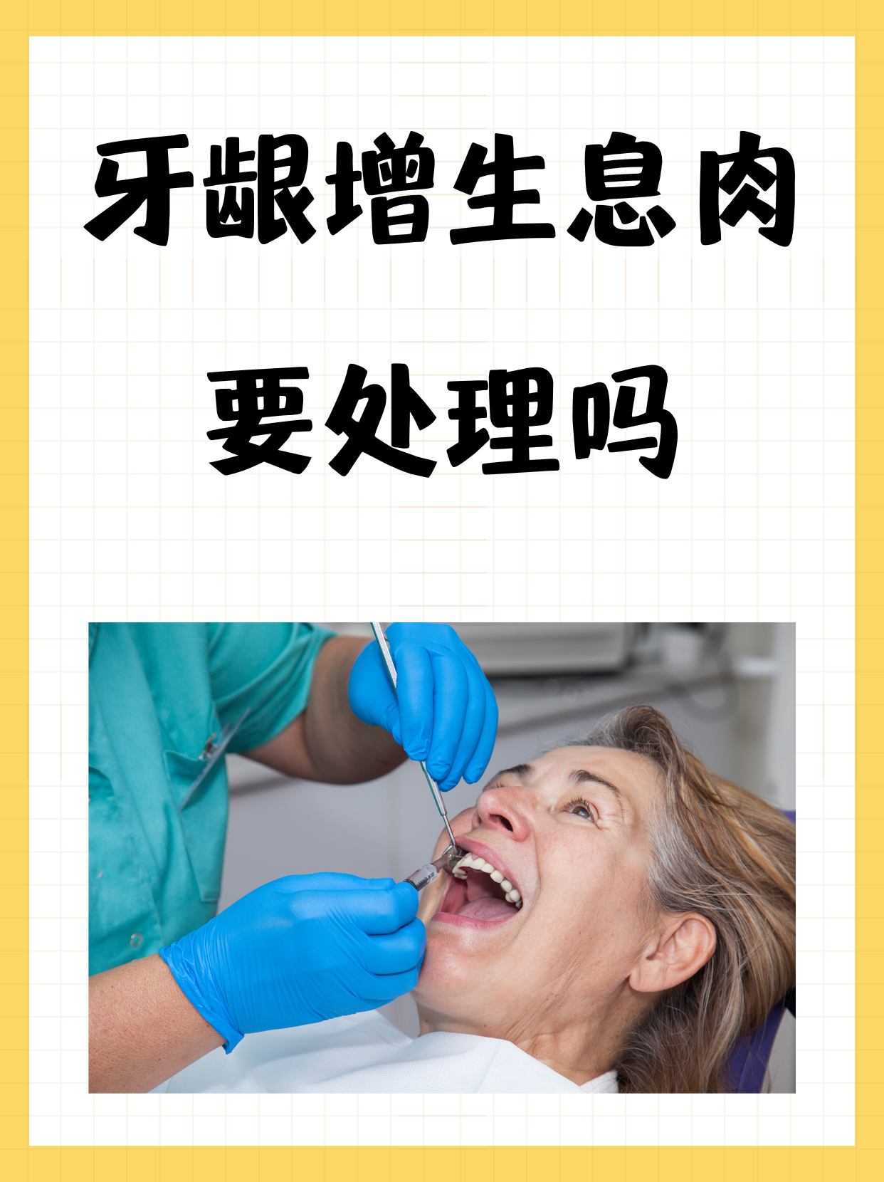 牙龈增长切除痛吗?