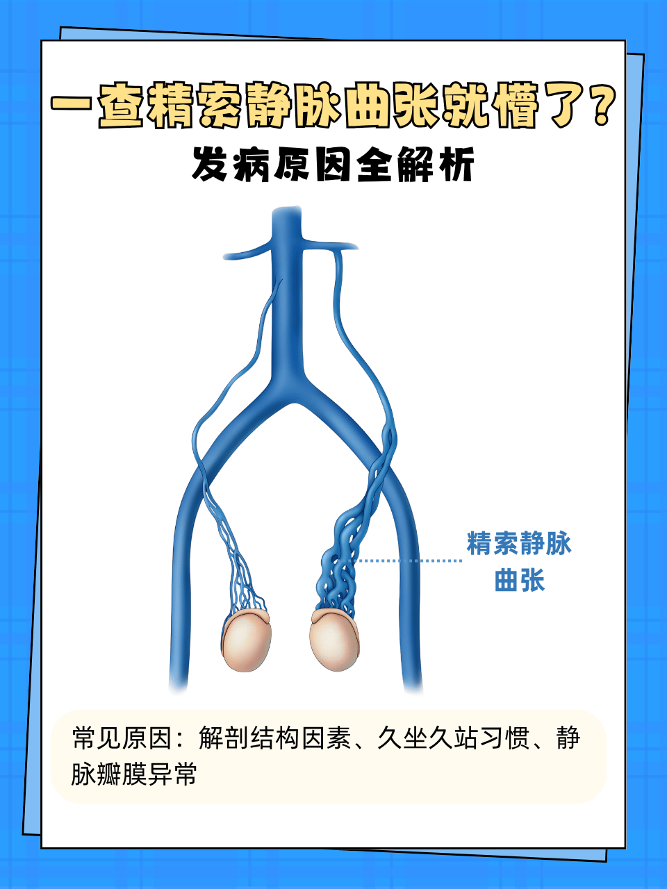 精索静脉曲张是怎么引起的?