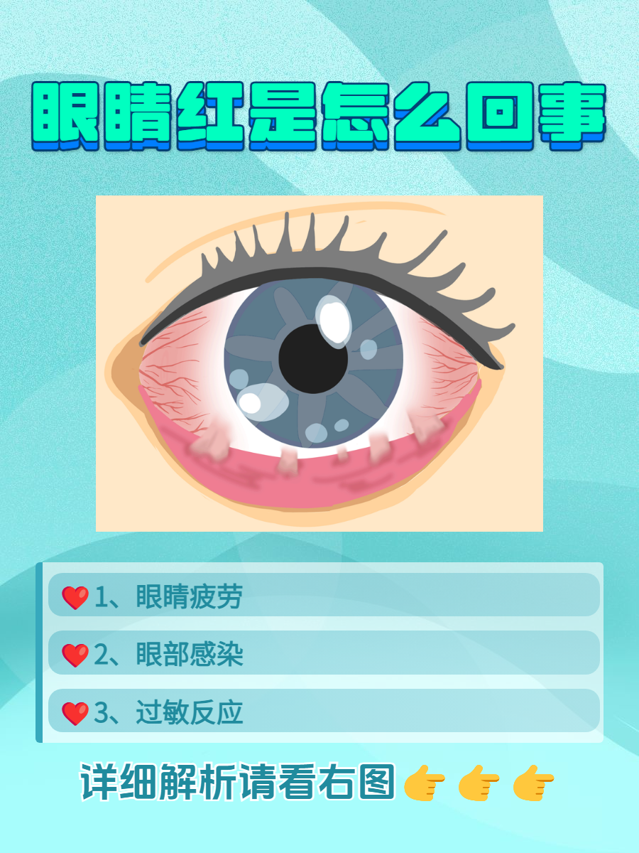 眼睛充血是有哪些原因导致