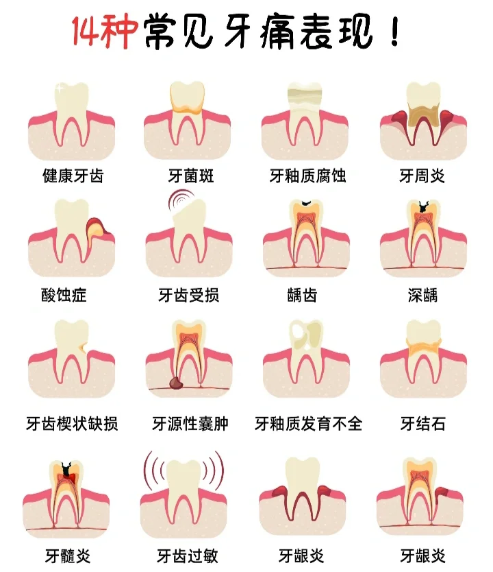 牙髓炎的症状有哪些表现?