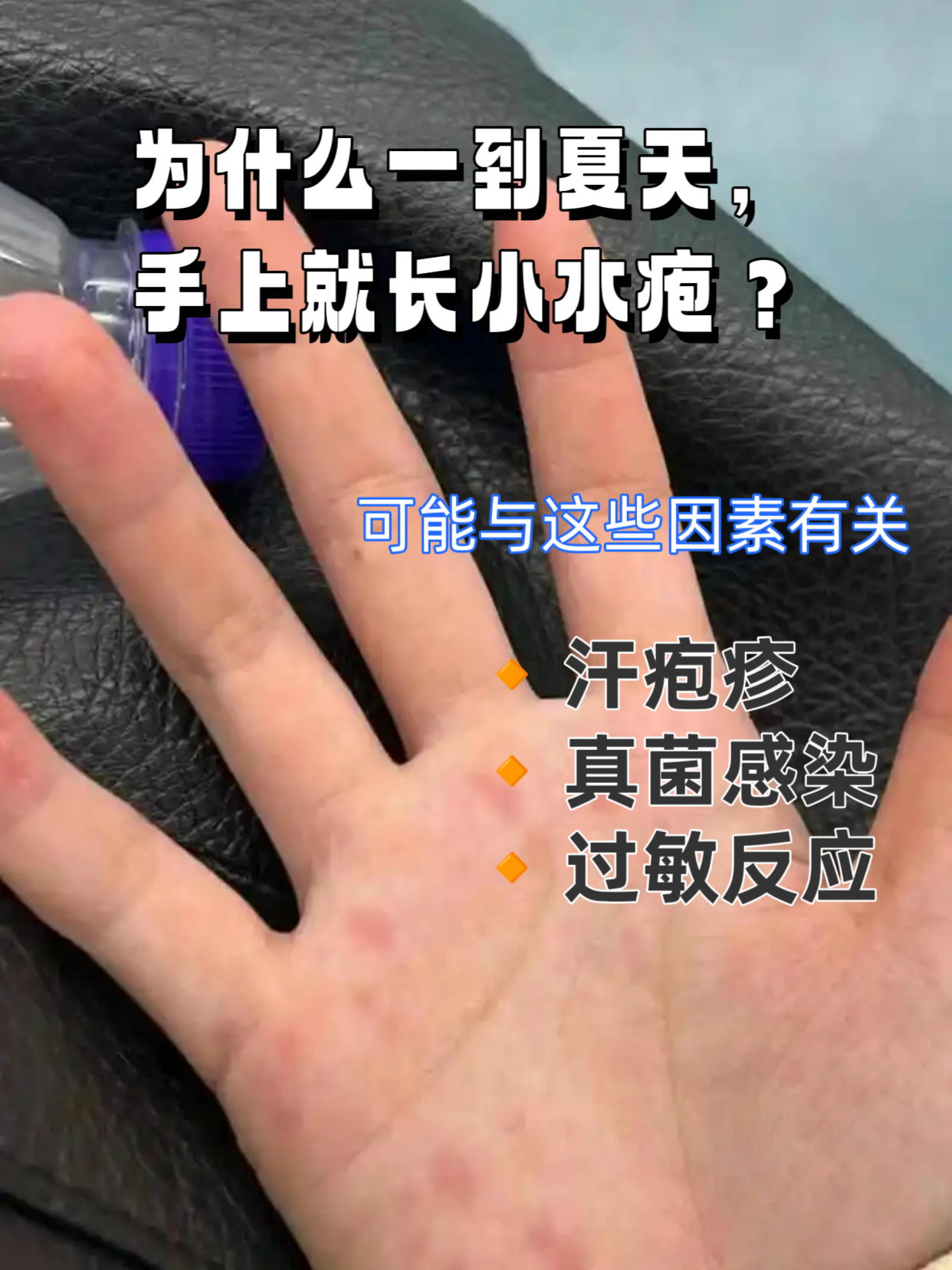 手上长小水泡很痒怎么办