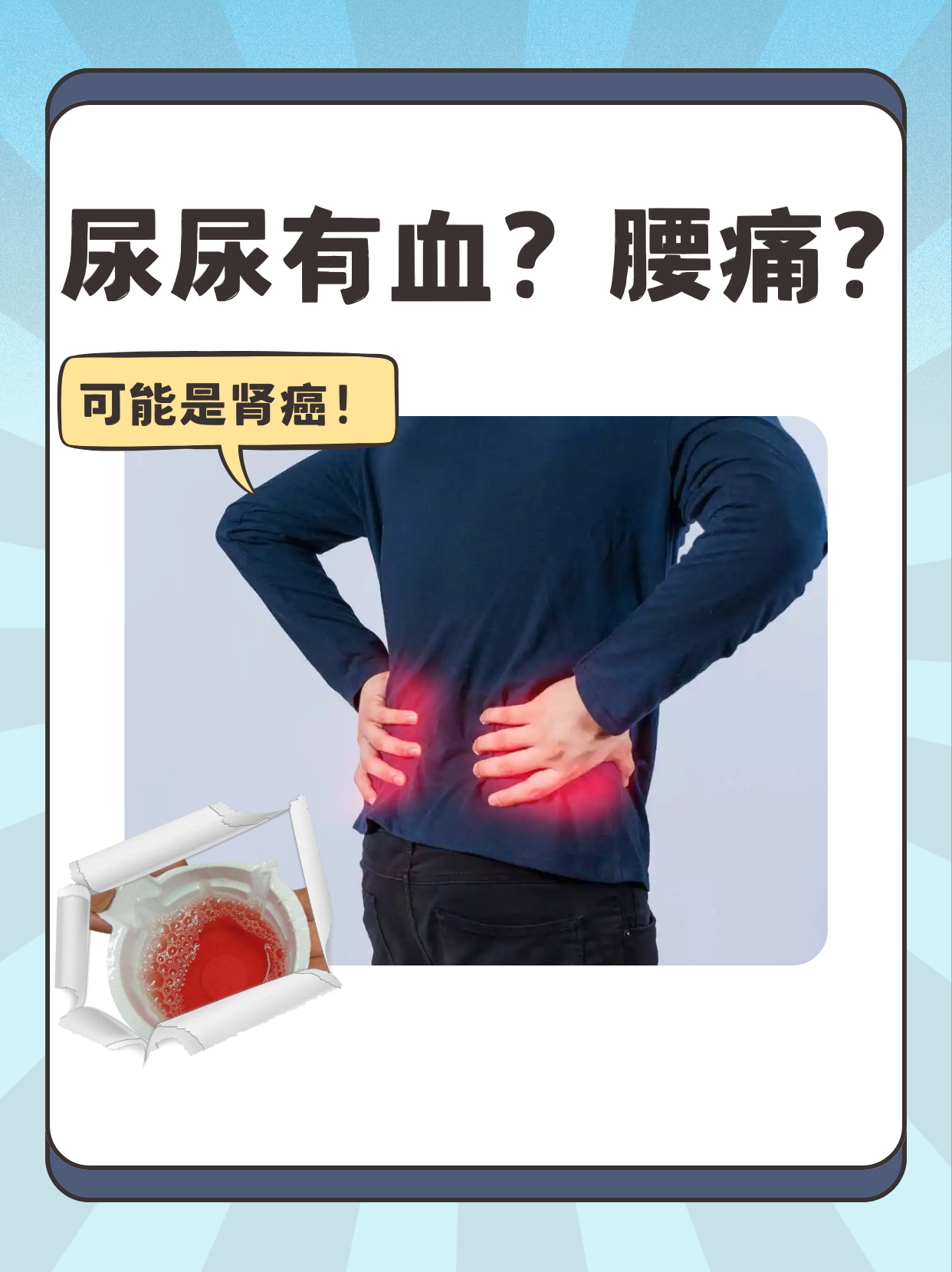 血尿的表现有哪些?