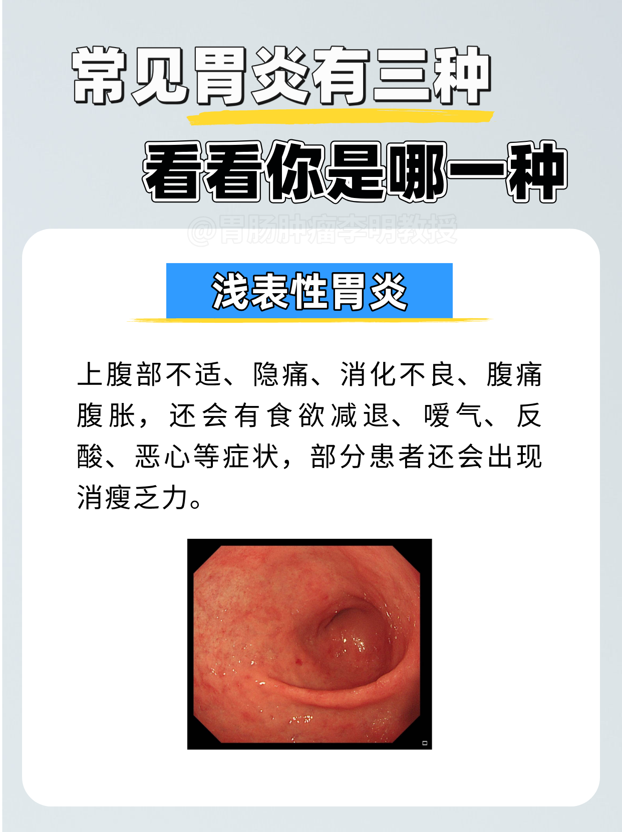 肠胃不好会有什么症状