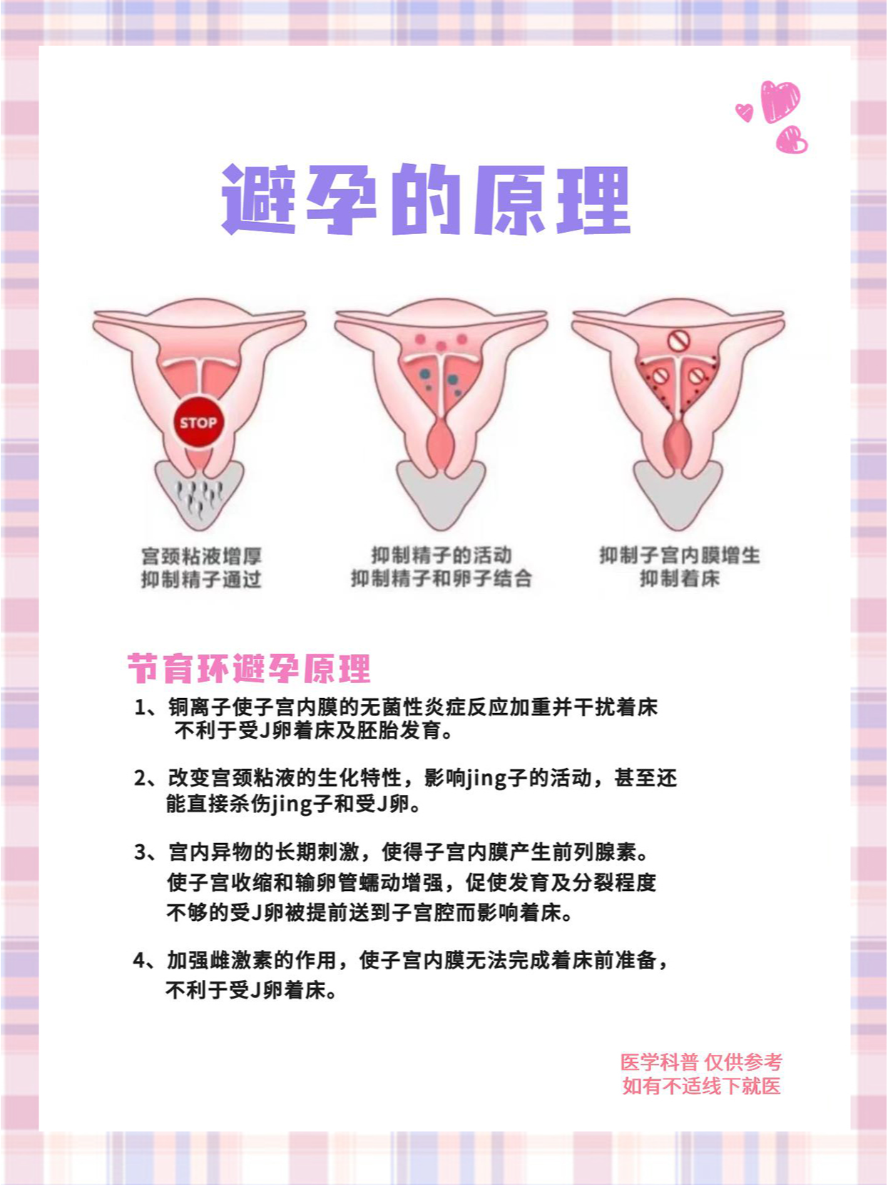 什么节育环好