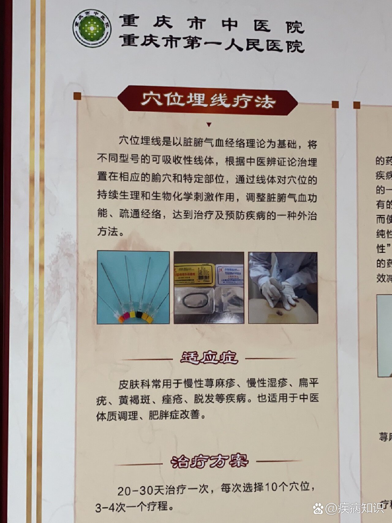 如何治疗慢性荨麻疹