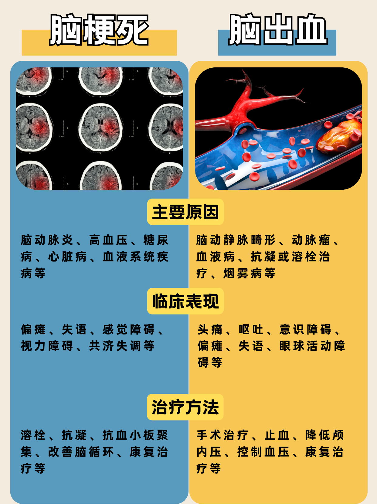 脑出血最常见的病因有哪些