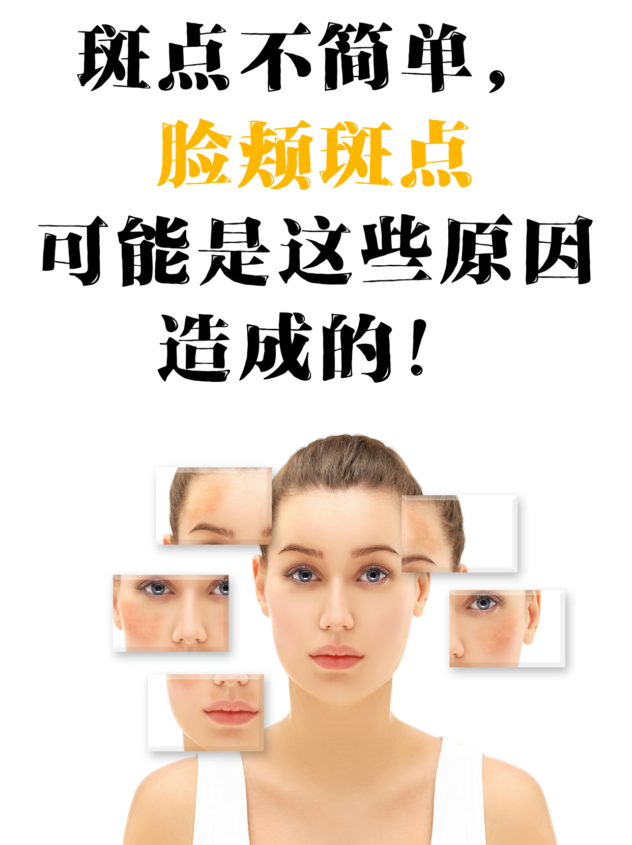 引起雀斑的因素和原因有哪些?