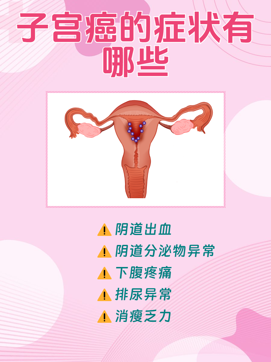 宫颈癌早期症状都有哪些