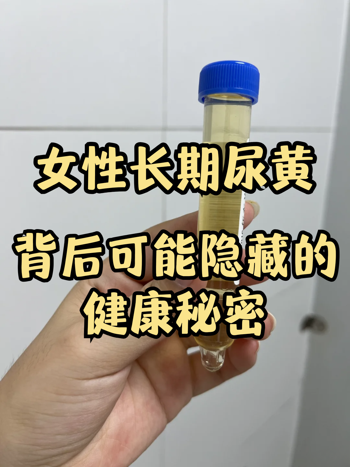 尿液黄是怎么回事