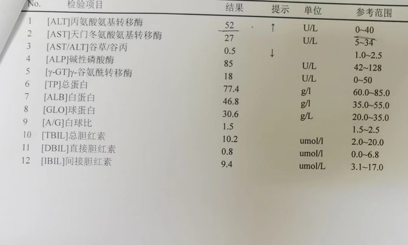 体检alt是什么意思