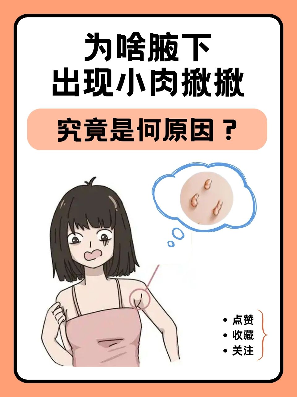 纤维瘤是什么原因造成的?