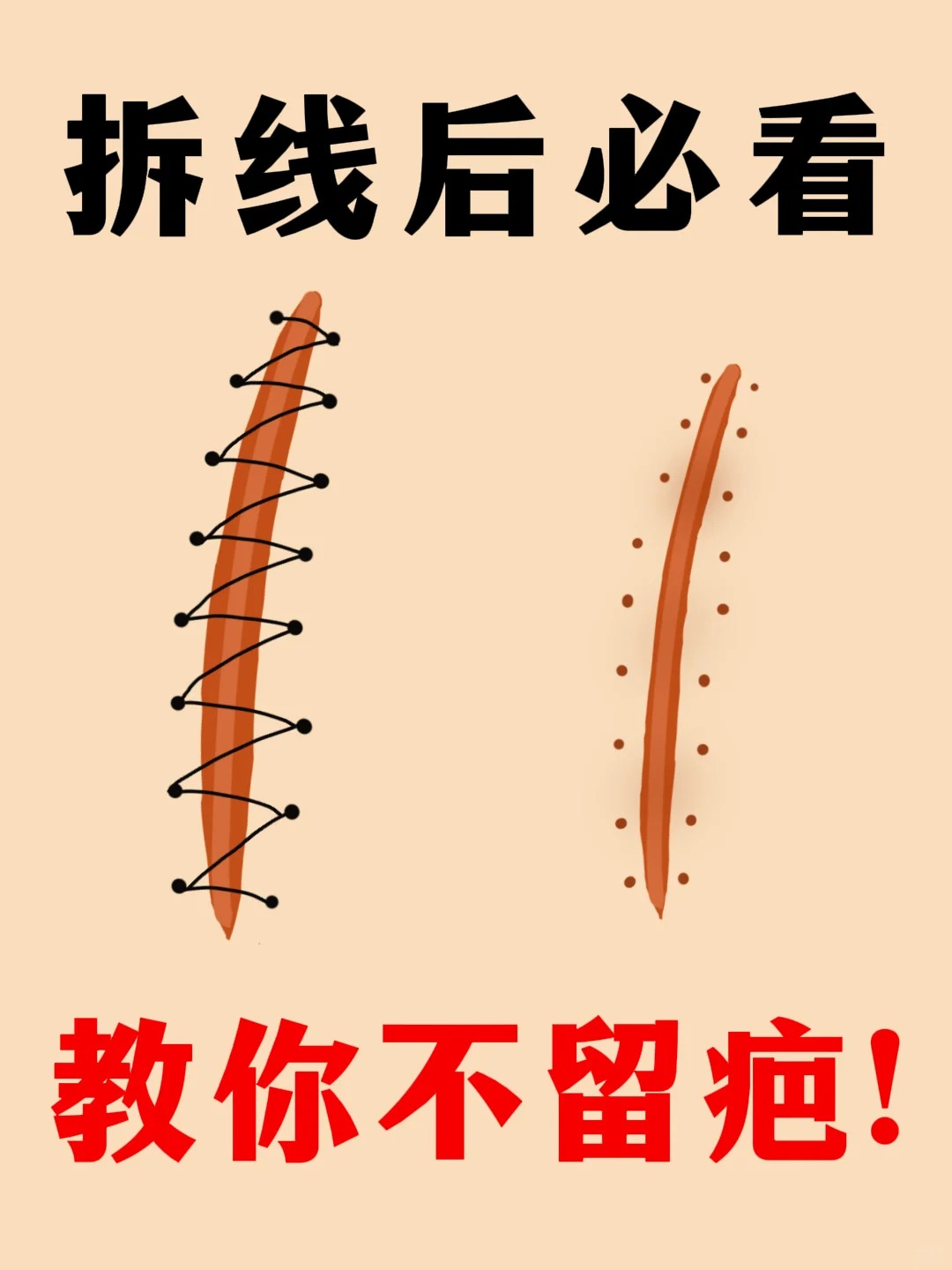 拆线的时候会疼吗