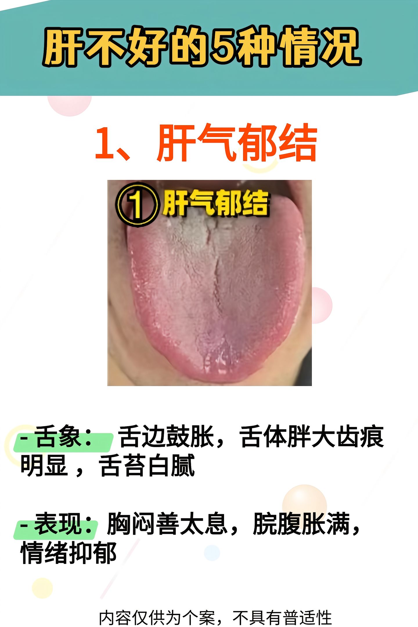 女性肝火太旺的表现