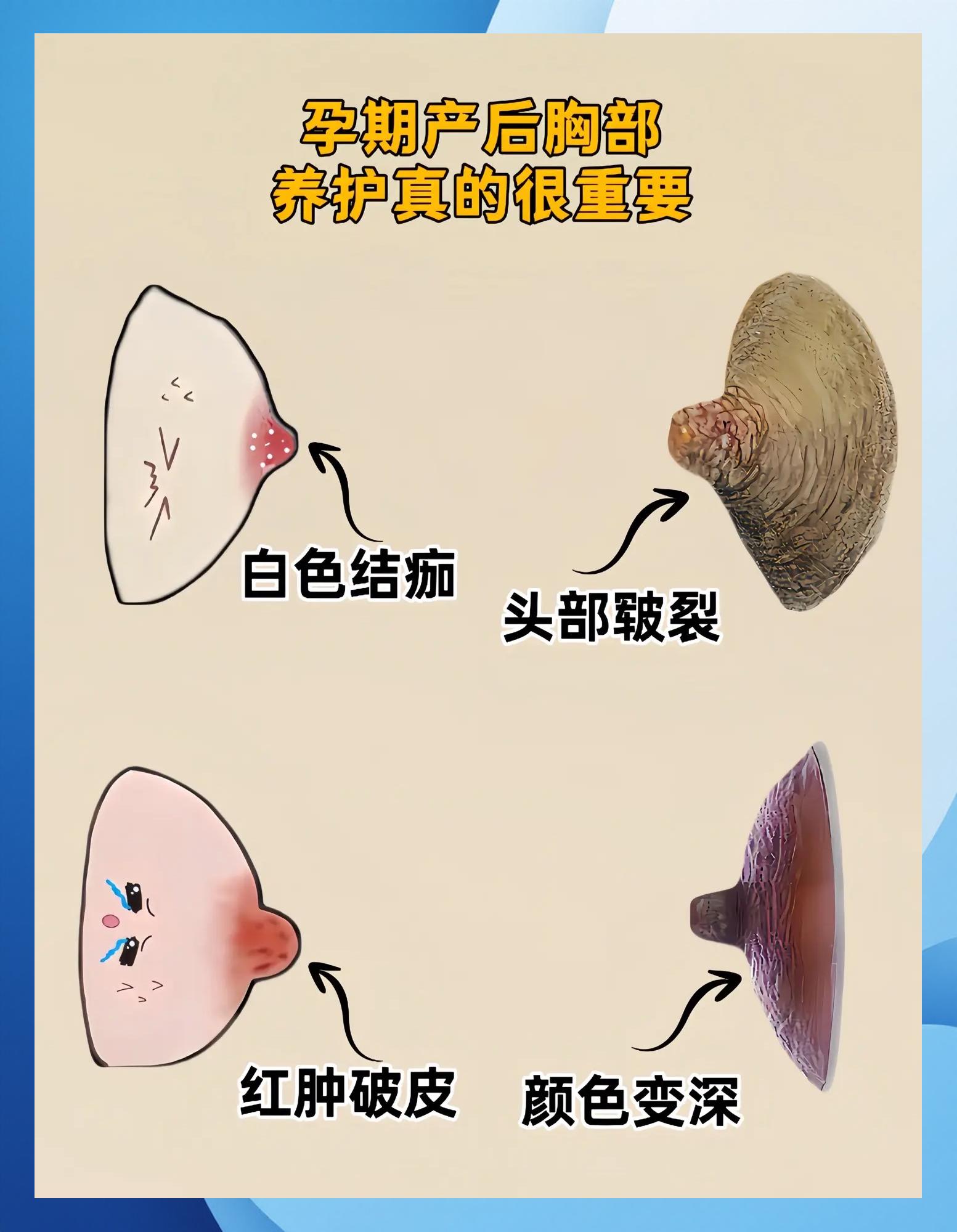 奶头过小怎么办!!!!!!!!
