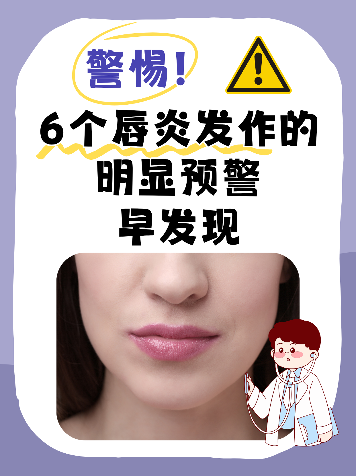 嘴唇痒怎么回事?