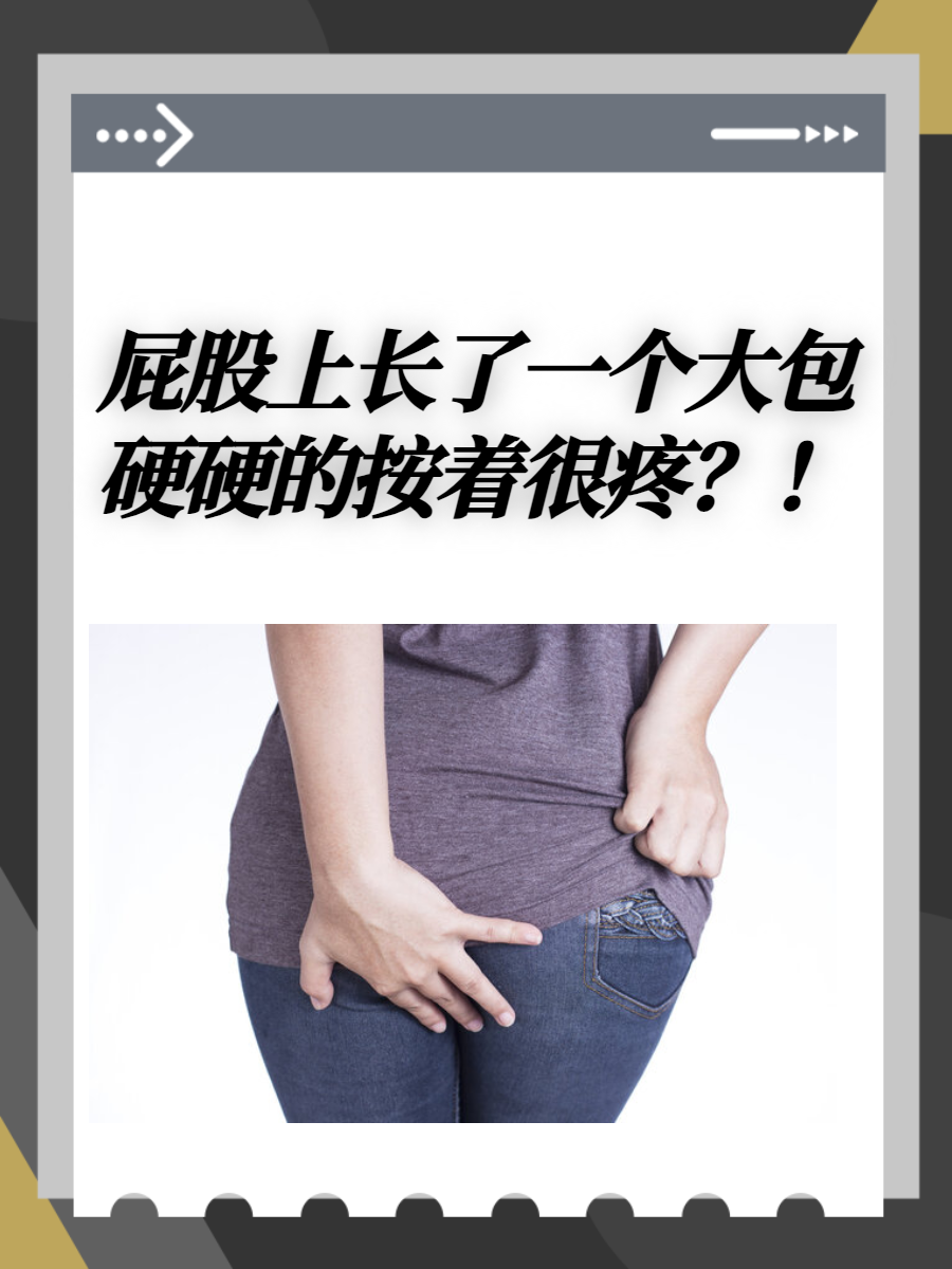 屁股里面长个包一碰就疼