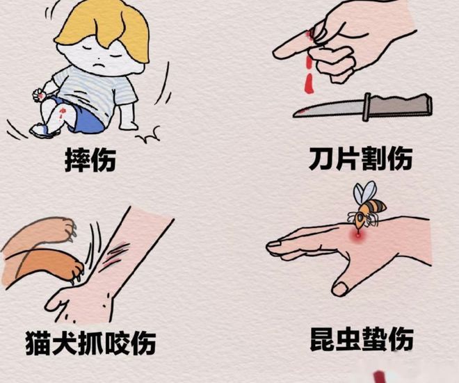 破伤风有什么症状表现