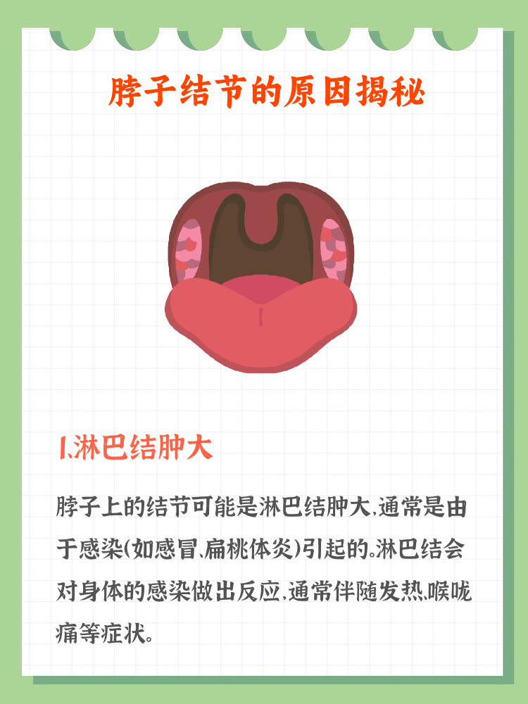 甲状腺癌淋巴转移征兆