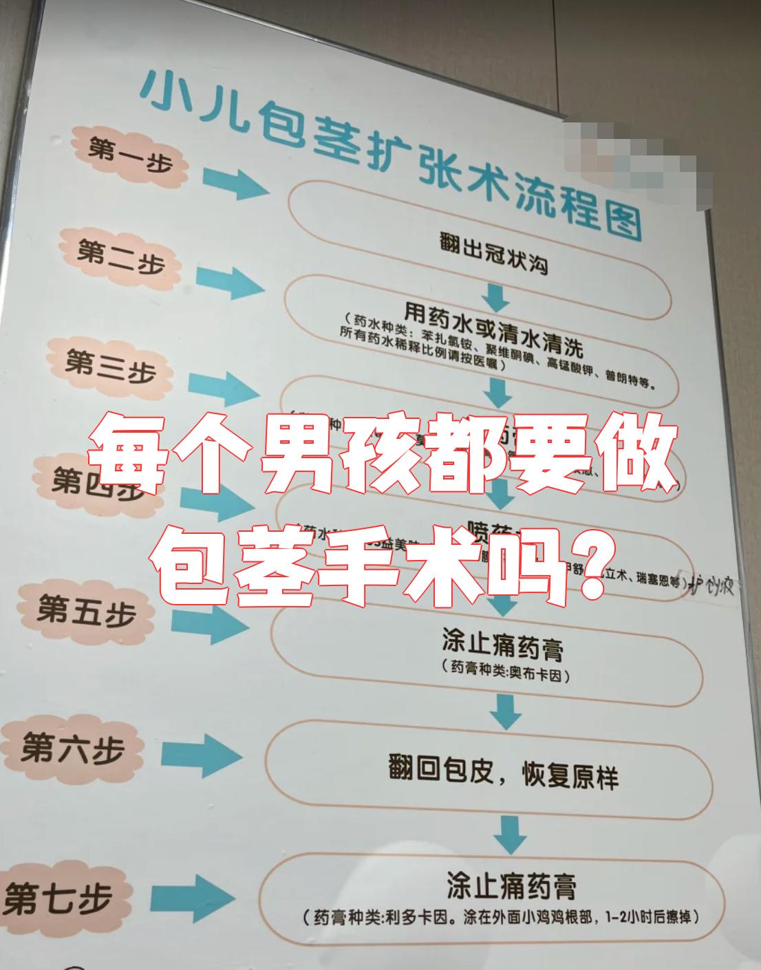 包皮必须要割吗?