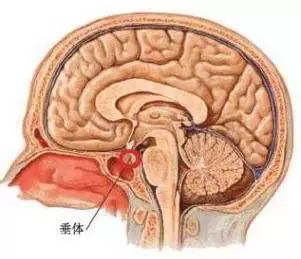 垂体瘤的症状有哪些?