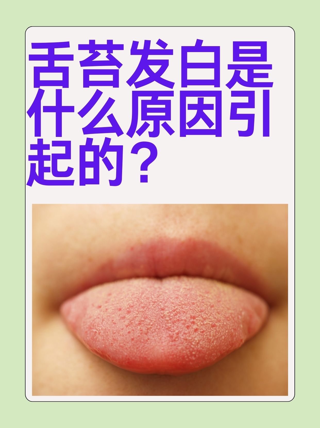 舌苔发白有齿痕怎么回事