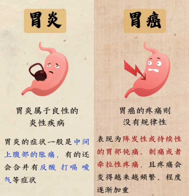 胃癌的早期表现症状有哪些
