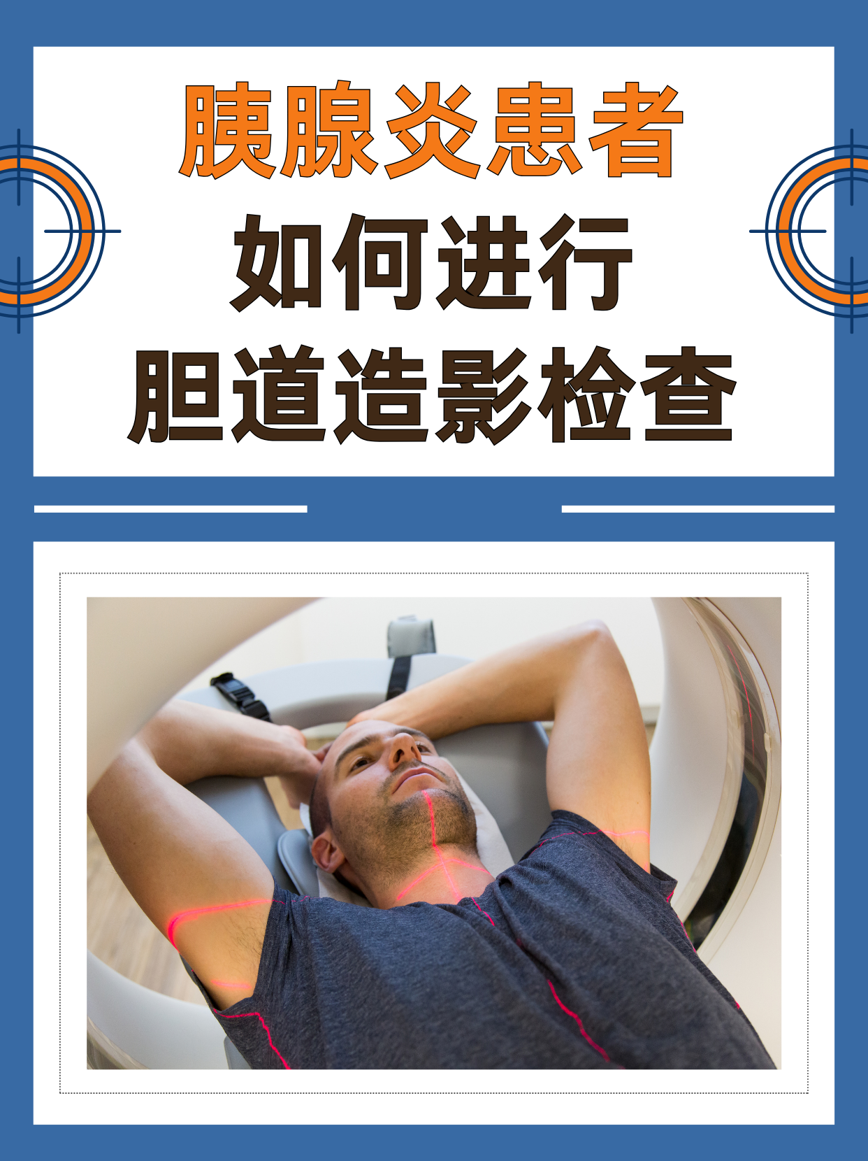 如何检查胰腺