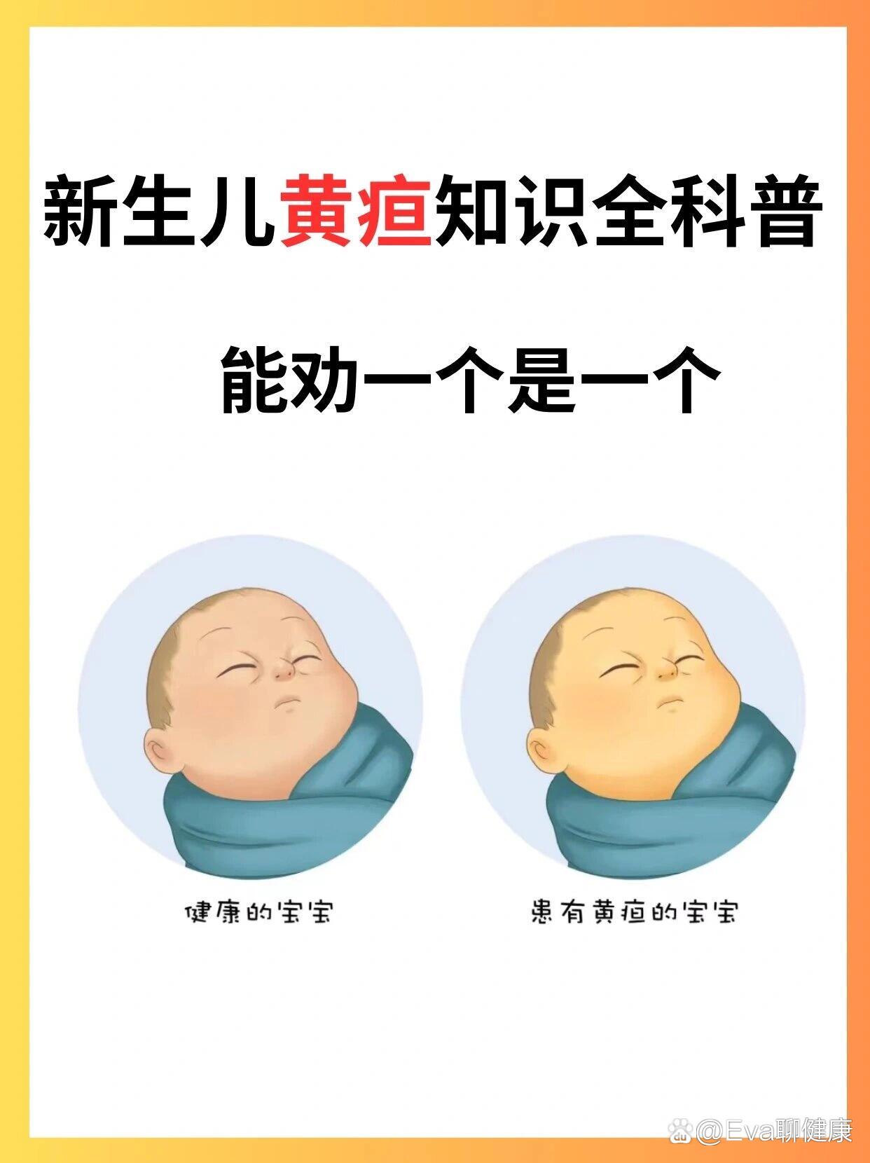 新生儿黄疸怎么治疗