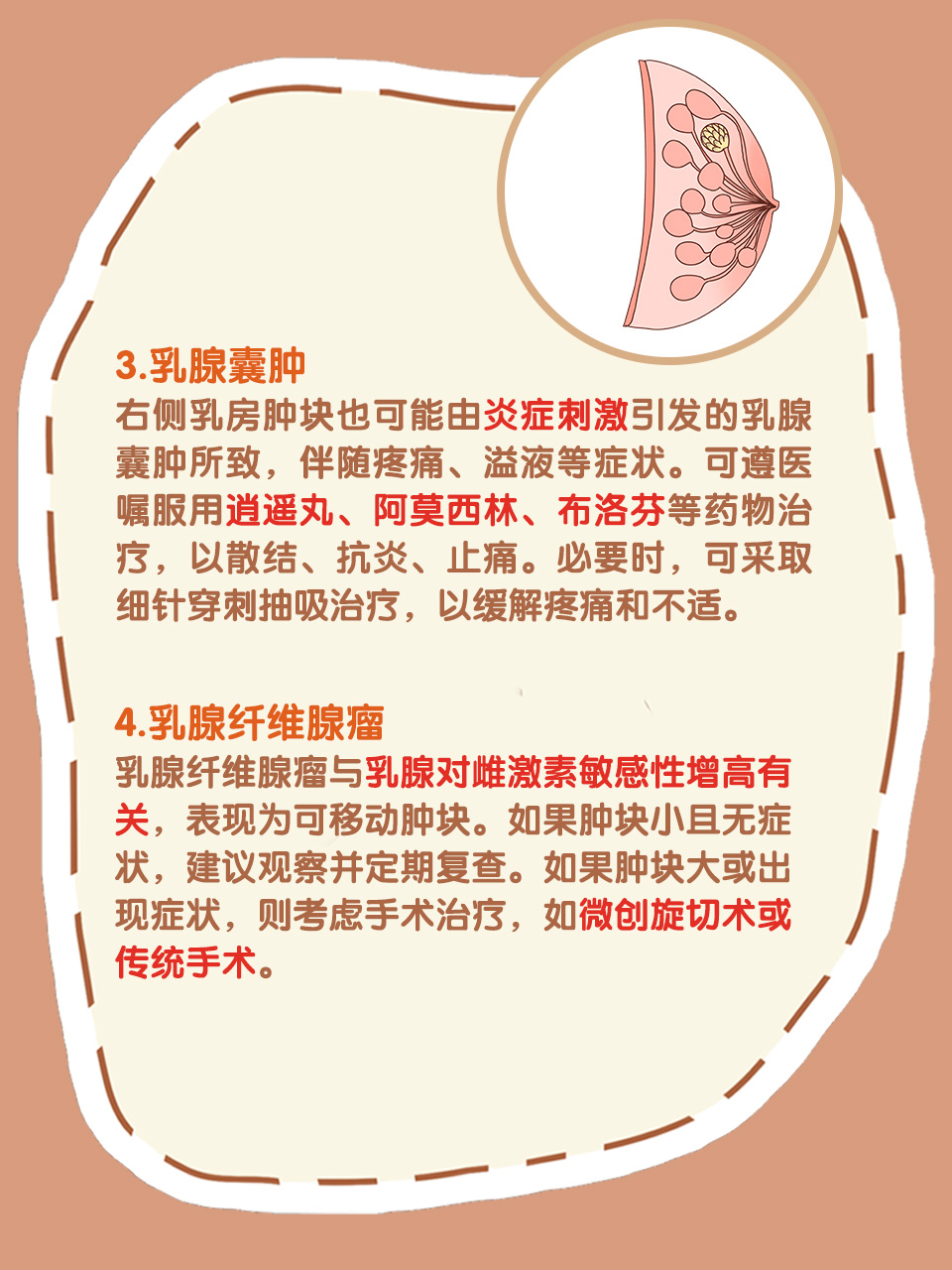 乳房肿块是什么