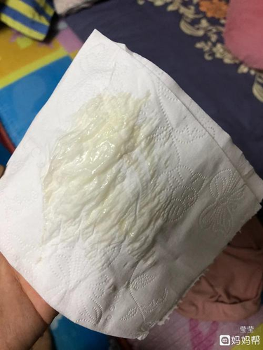 怀孕初期白带多正常吗