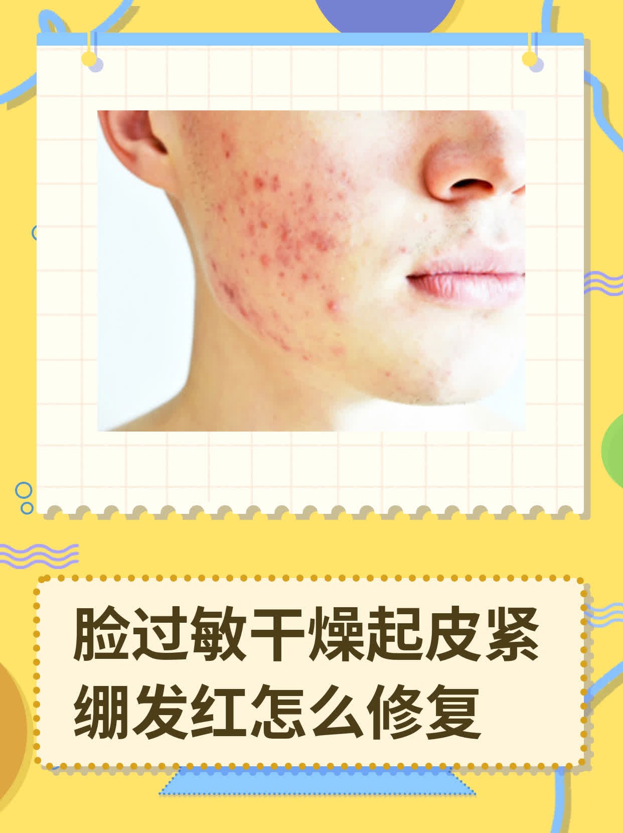 脸部皮肤过敏怎么办