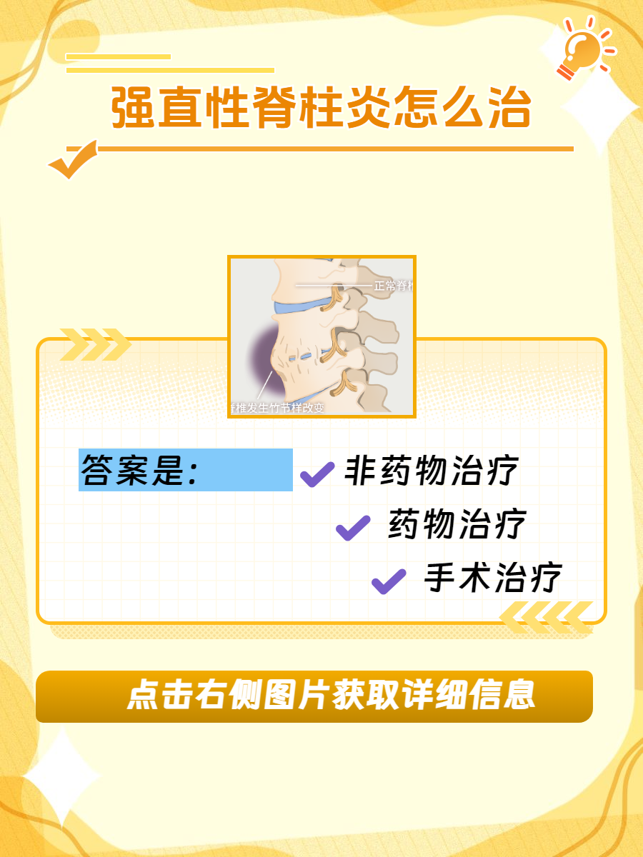 强直性脊柱炎怎么保养