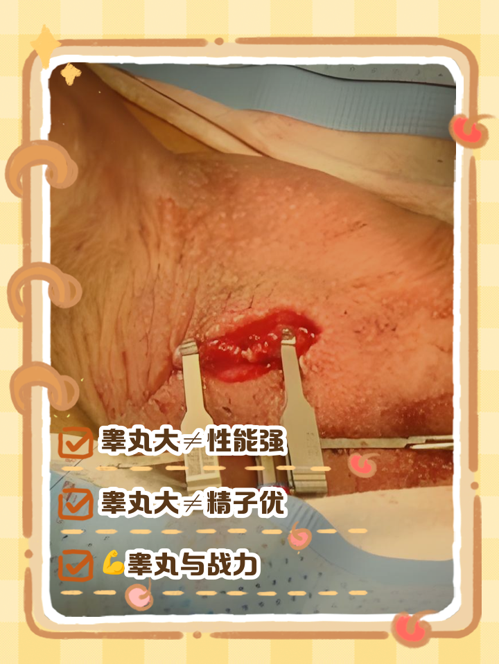 帮我看看孩子的睾丸正常吗