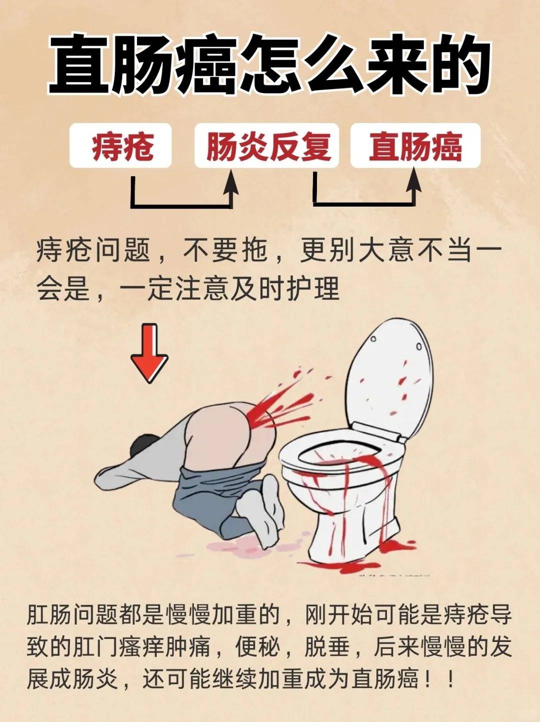 肠癌症状的早期表现有什么