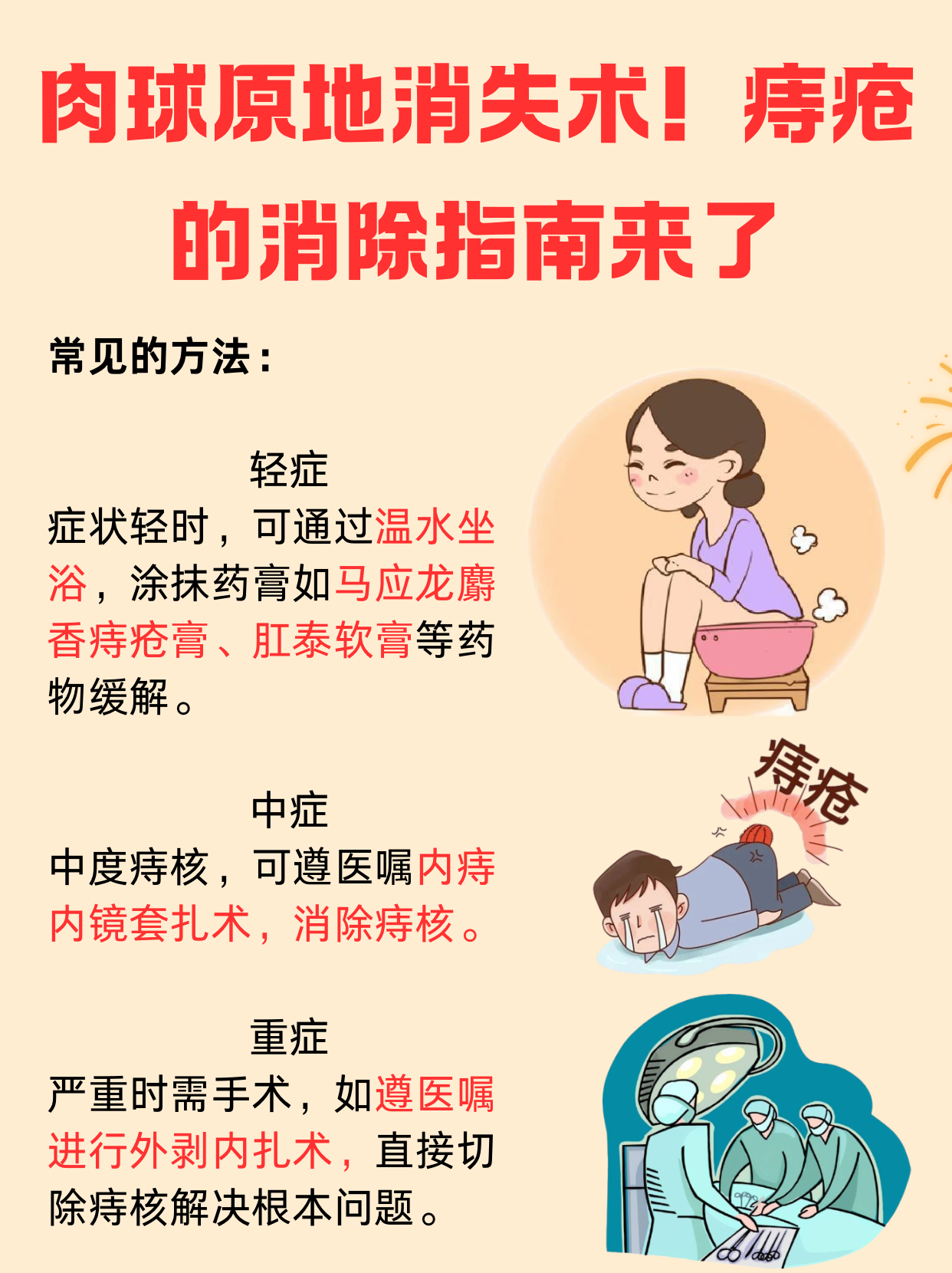 如何治疗痔疮