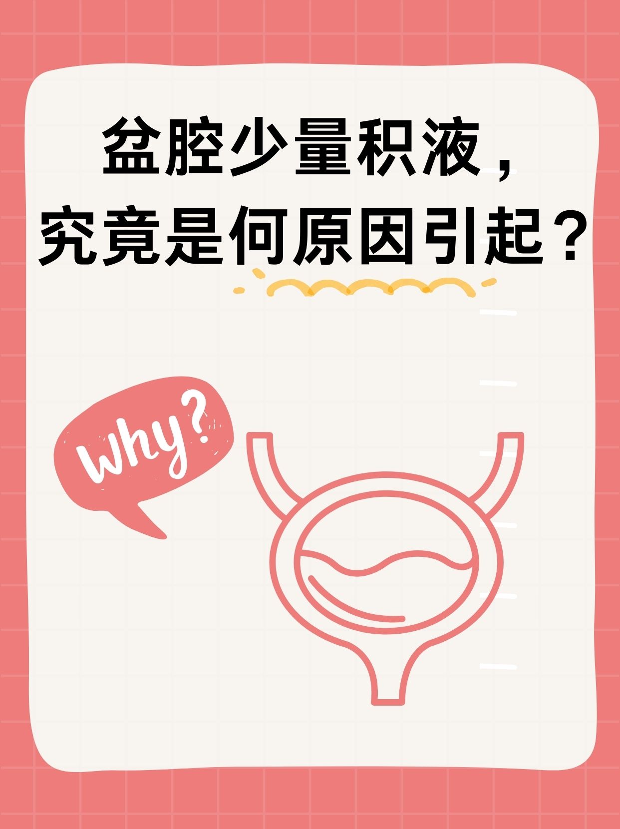 盆腔积液是怎么回事