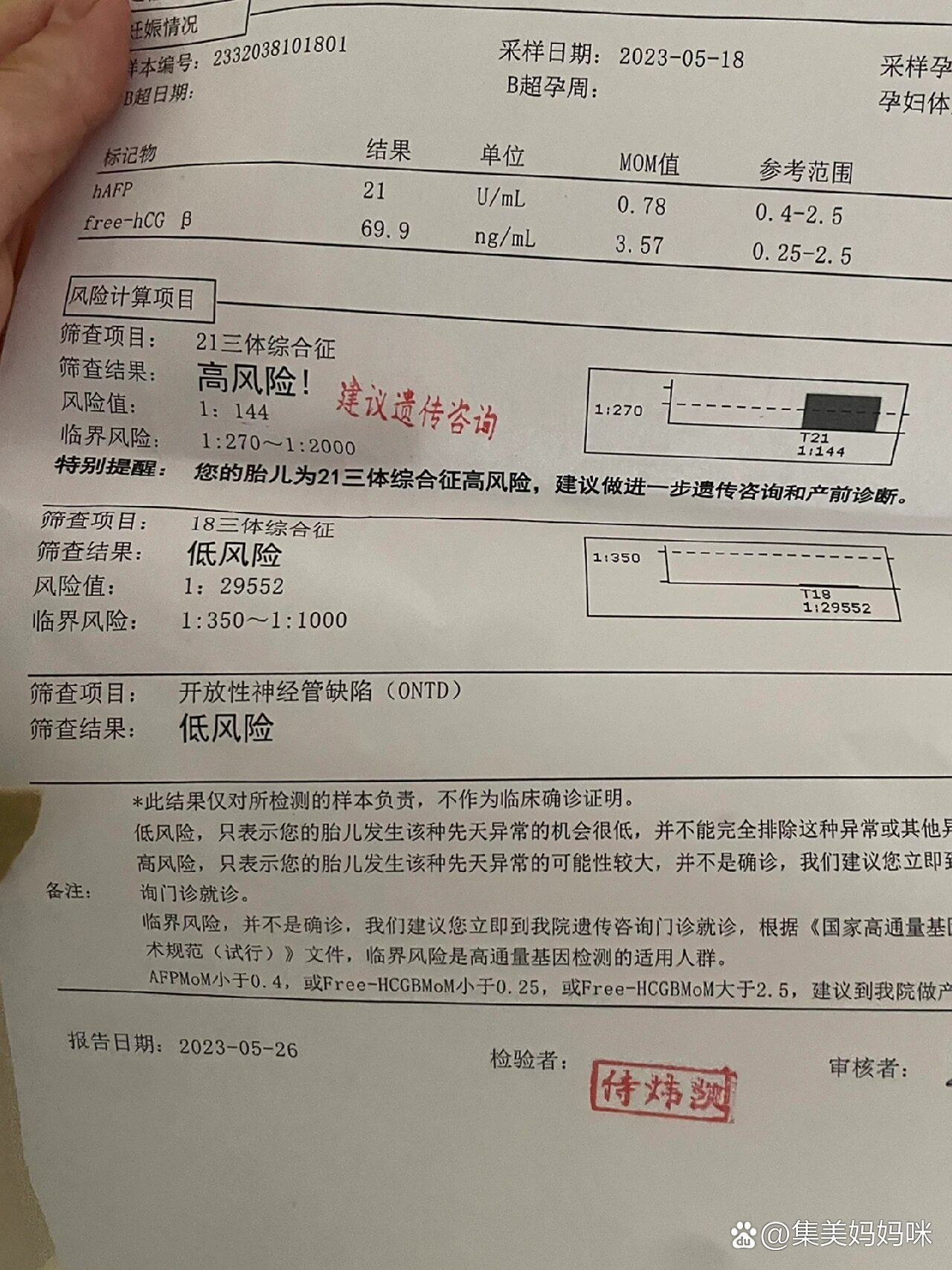 21三体综合征正常范围