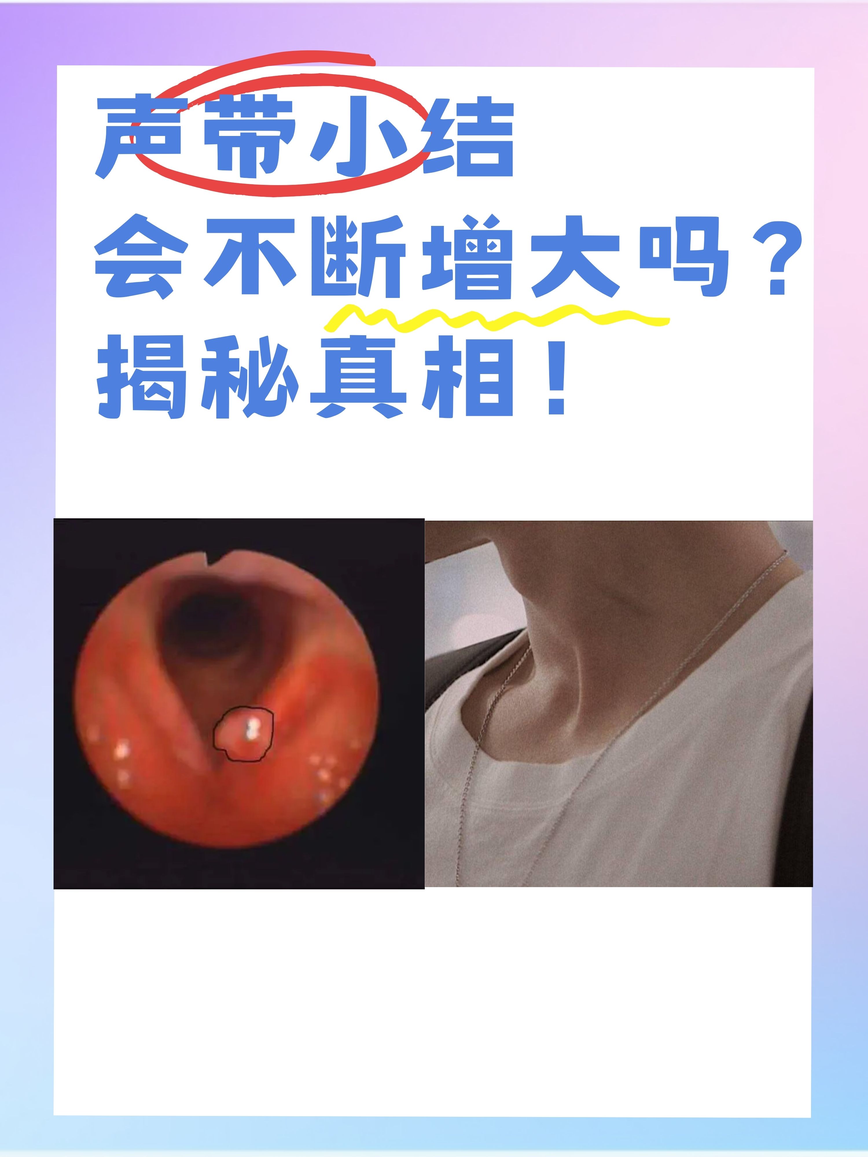 声带损伤能恢复吗?