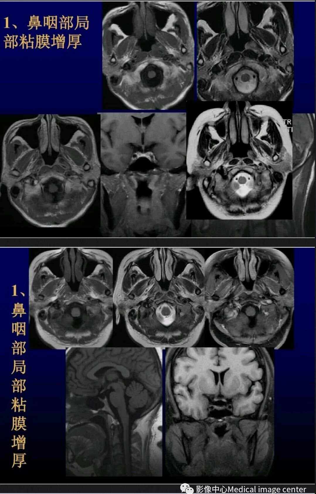 mri检查是什么